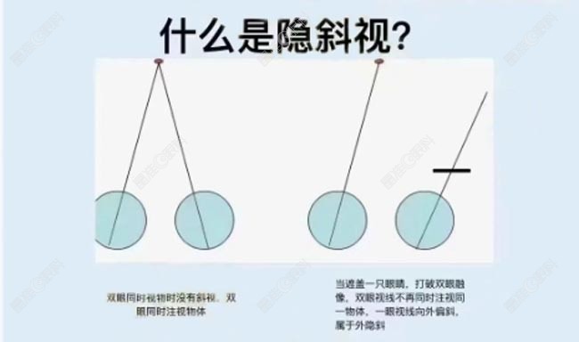 隐性斜视出现的原因主要是这几点www.ji-zhun.com