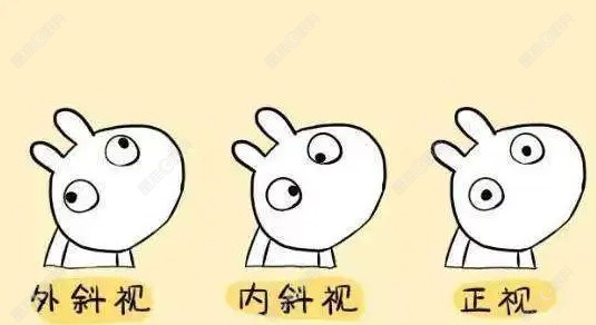 成人隐性斜视会越来越明显吗