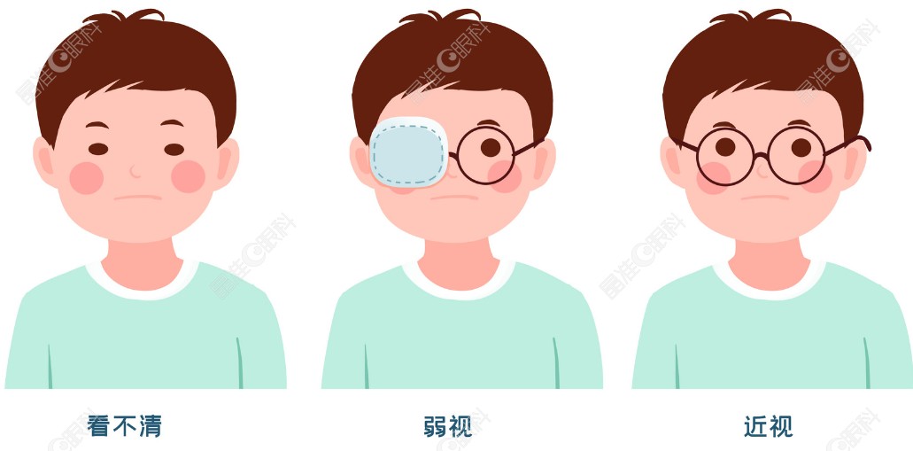 杨槐医生矫正斜视近视怎么样