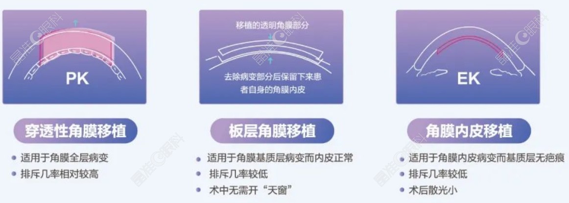 角膜移植手术的三种方式