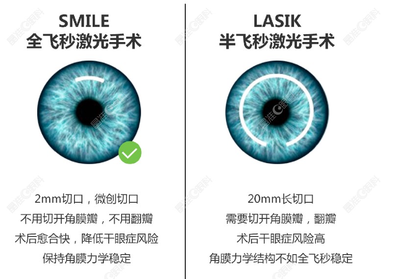 全飞秒和半飞秒近视手术区别