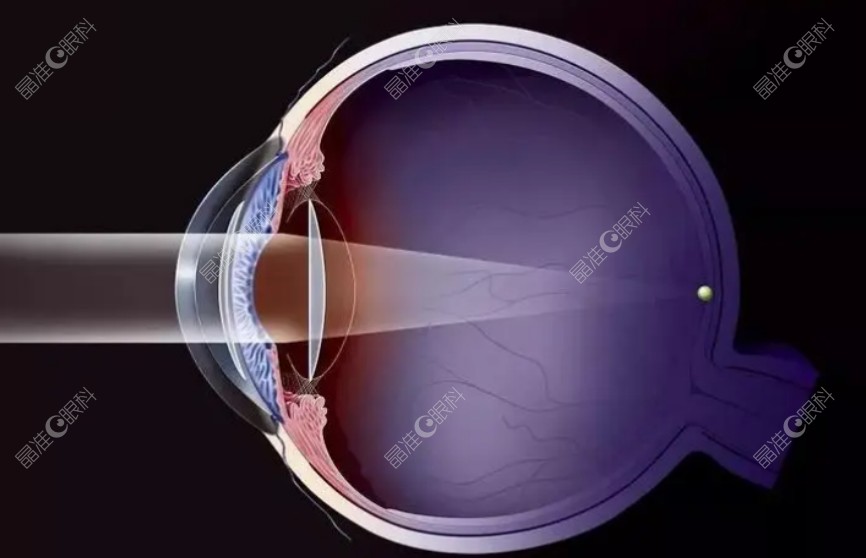 北京爱尔眼科近视手术ji-zhun.com