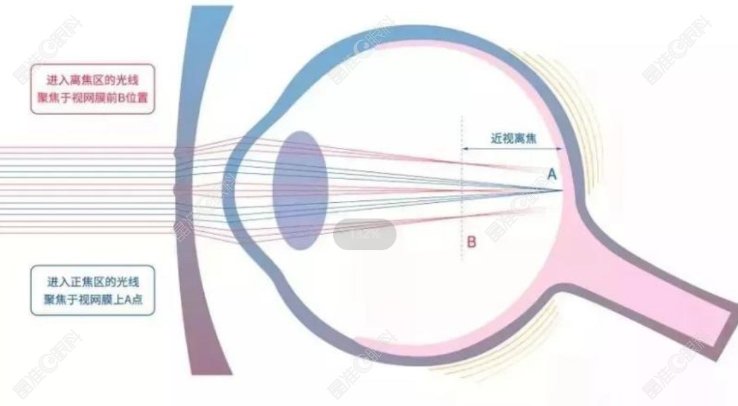 日本豪雅新乐学眼镜片矫正近视好