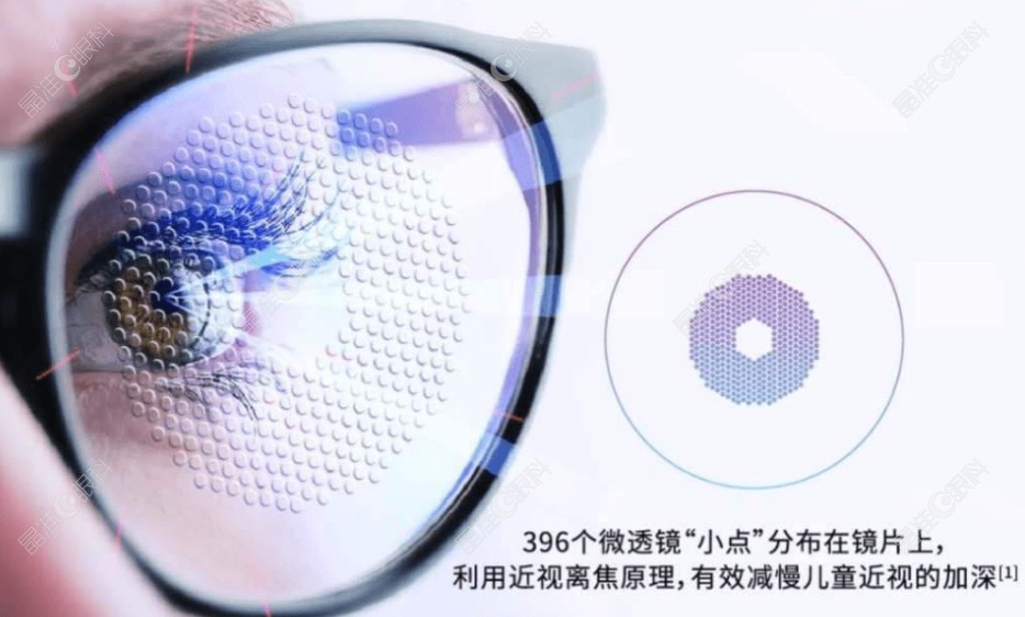 爱尔眼科离焦镜怎么样