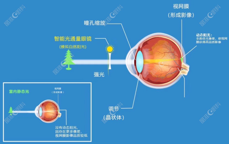 哺光仪治疗近视的原理