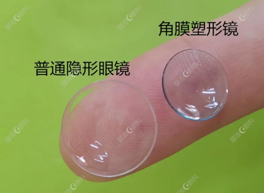 角膜塑形镜