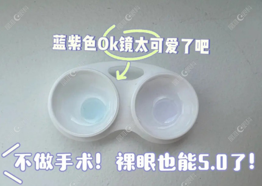 角膜塑形镜