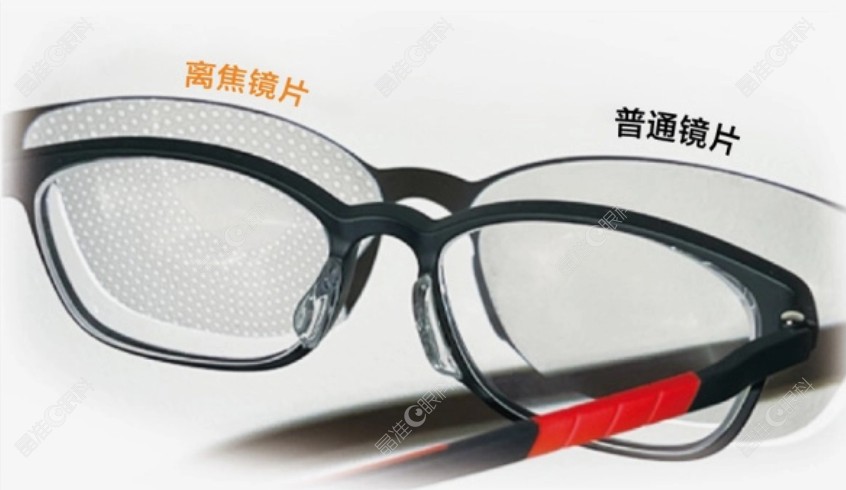 爱尔眼科配近视眼镜500元起