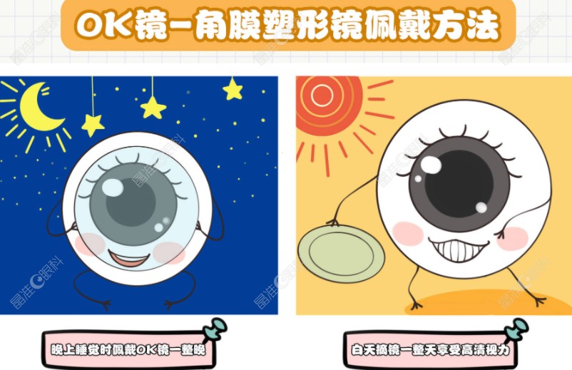 爱尔眼科配角膜塑形镜6000元起
