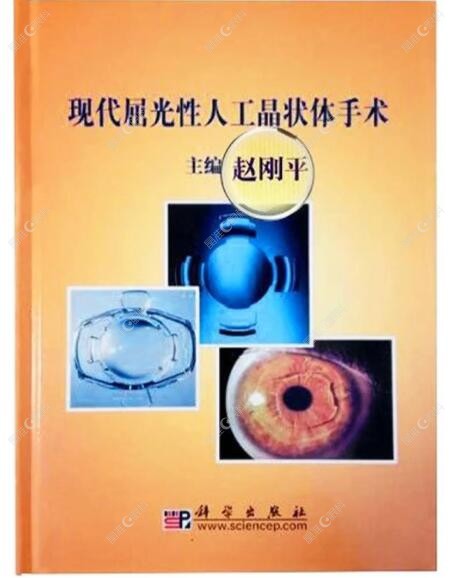 赵刚平眼科医生有多篇学术论文www.ji-zhun.com