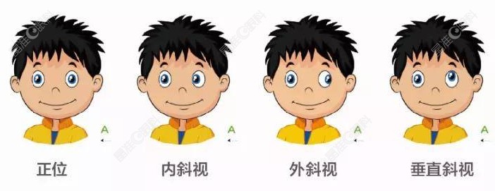 刘淑杰医生做儿童斜弱视怎么样