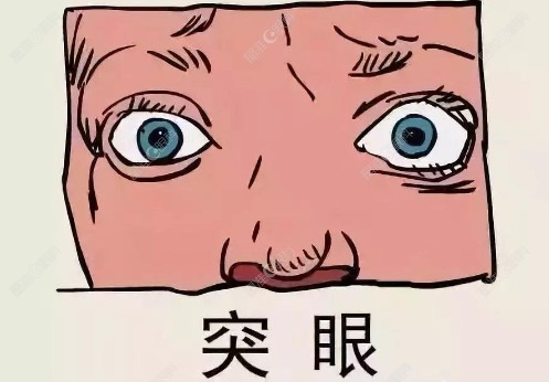 甲亢突眼问题