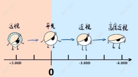远视储备值对视力的影响