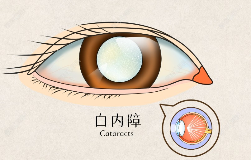 艾无极人工晶看远中距离清楚m.ji-zhun.com
