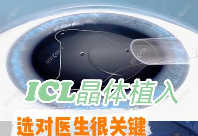 郑州尖峰眼科医院做icl晶体植入近视手术费用