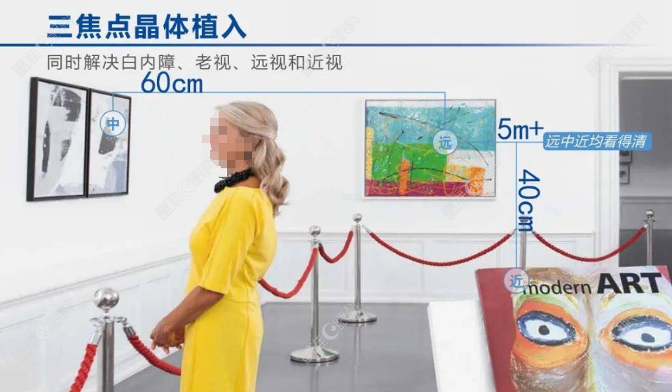 蔡司三焦点人工晶体839和939哪个好