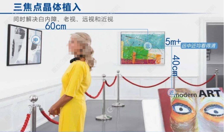 三焦点人工晶体植入后看东西真实图像
