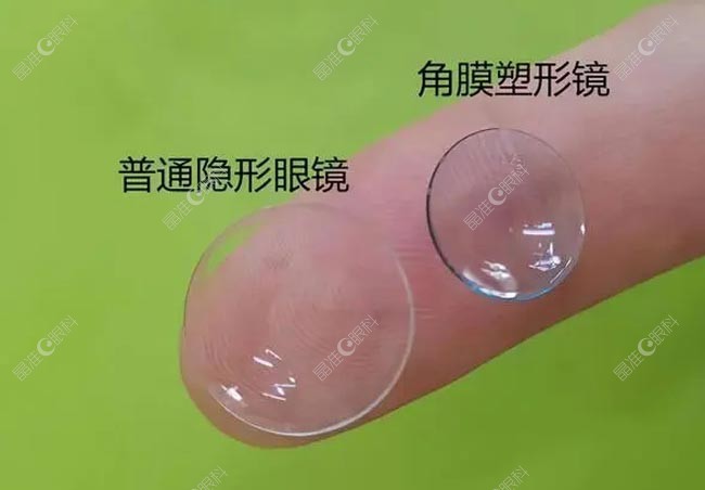 角膜塑形镜散光加深的原因有哪些
