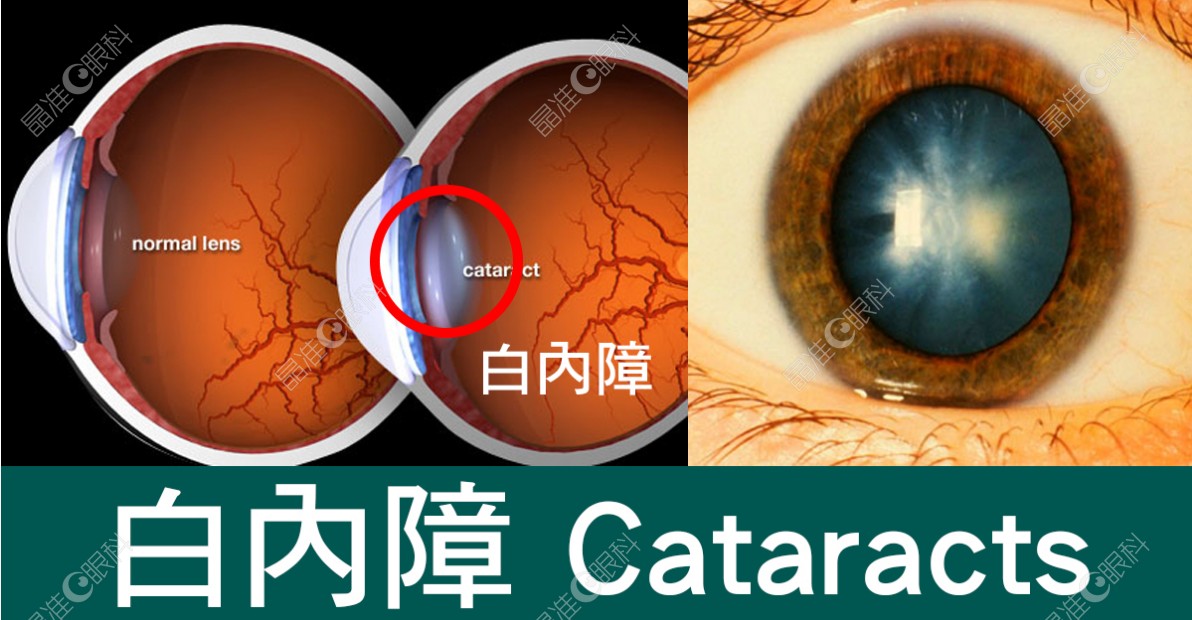 重庆普瑞眼科医院张朝军怎么样