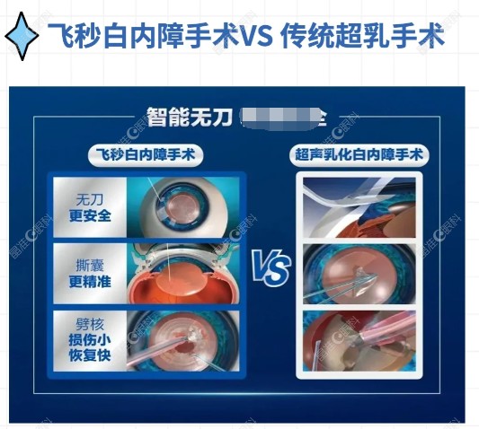 飞白无刀白内障优势多ji-zhun.com
