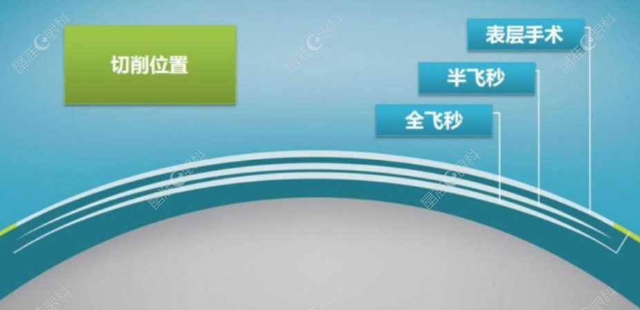 广州视百年眼科价格靠谱透明