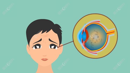 玻璃体浑浊需要做切除手术还是玻璃体消融术