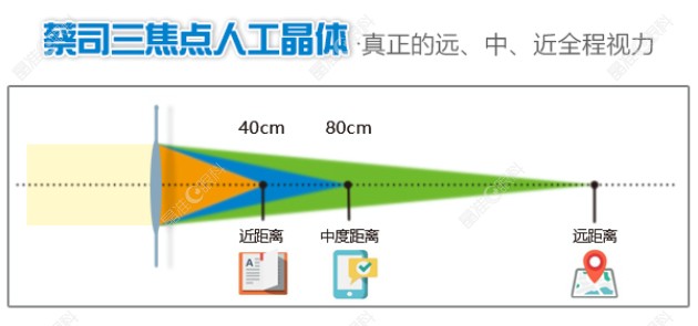 蔡司三焦点晶体远中近都看得清