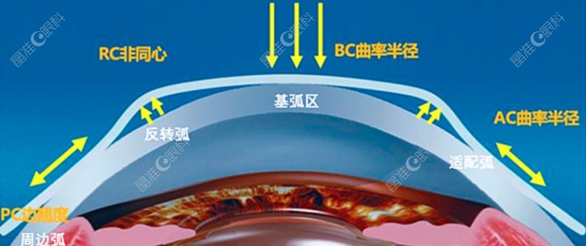 普诺瞳角膜塑形镜的真实评价www.ji-zhun.com