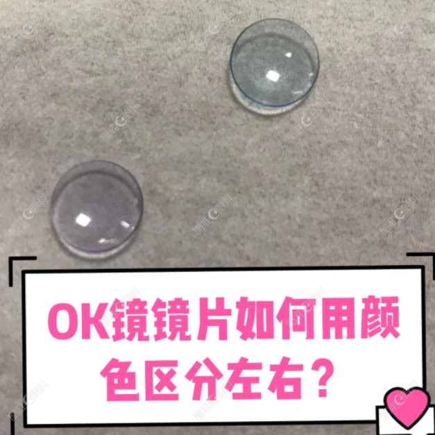 露晰得角膜塑形镜左右眼颜色区分是怎么判断的