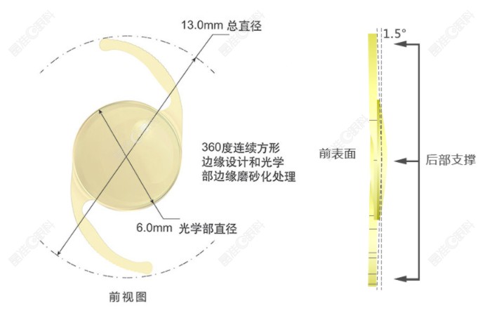 爱博诺德肝素改性高次非球面人工晶状体AQ