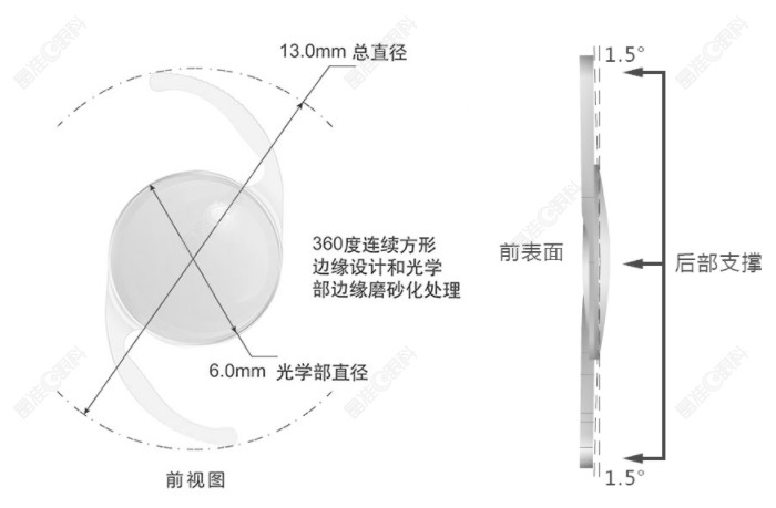 爱博诺德高次非球面人工晶状体AW-UV