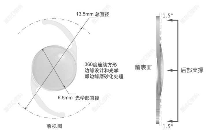 爱博诺德大光学区高次非球面人工晶状体ALD