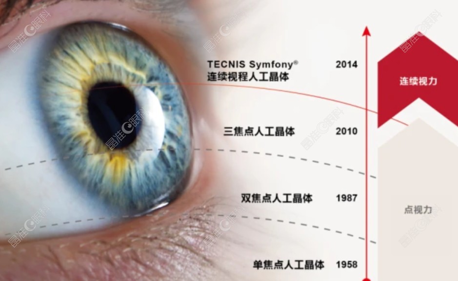 进口美国爱尔康新无极人工晶体怎么样