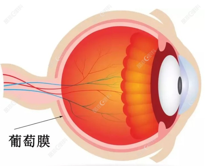 得过葡萄膜炎恢复后可以做近视手术吗?www.ji-zhun.com