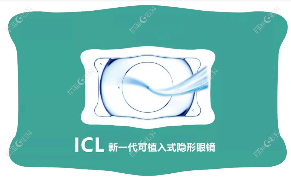 ICL晶体矫正近视原理