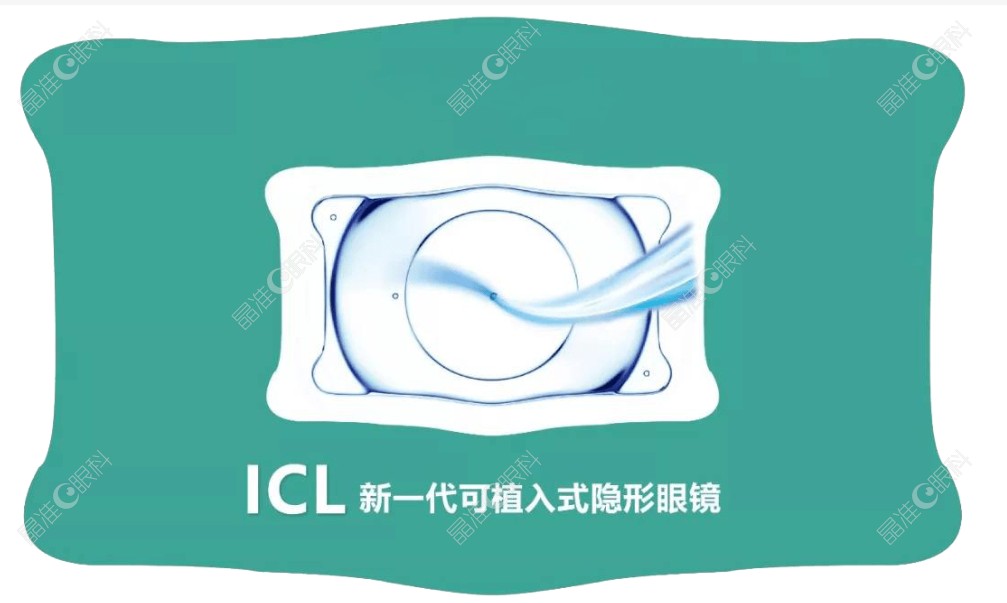 广州人工晶体icl价目表