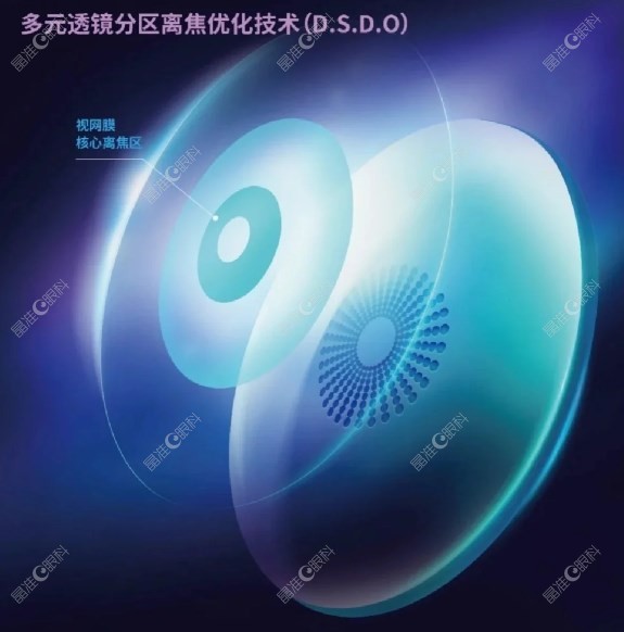 奥拉怒放离焦镜片的优势