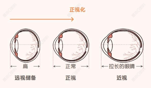 远视储备不足是什么意思