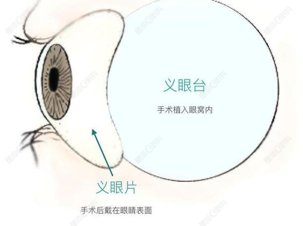 义眼价格表一览2023公布www.ji-zhun.com