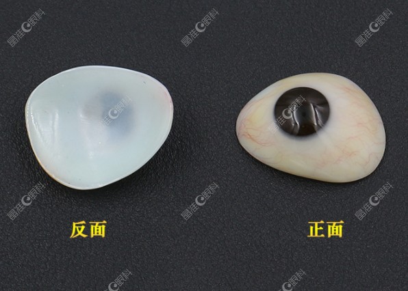 义眼台植入术手术费用多少？