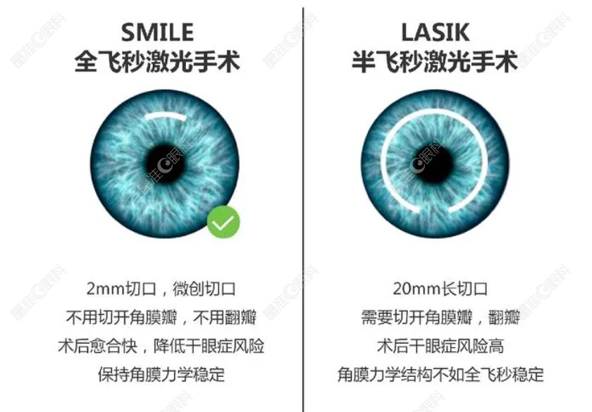 全飞秒手术和半飞秒手术区别