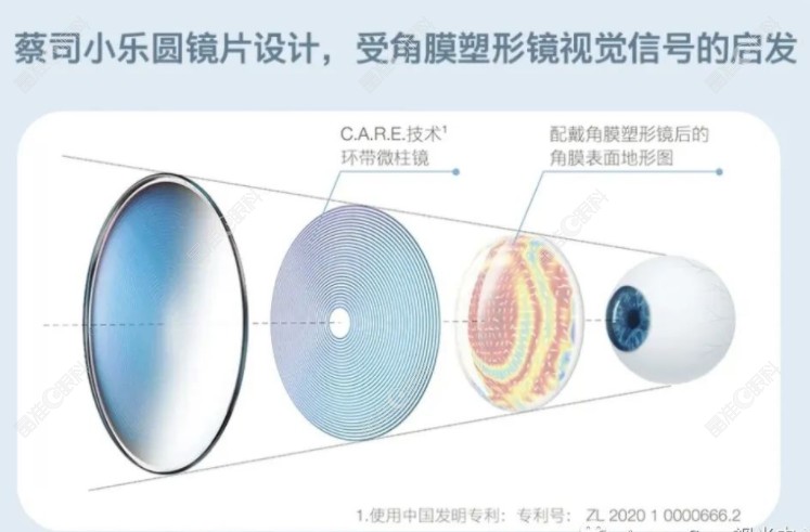蔡司小乐园镜片防控近视疗效好