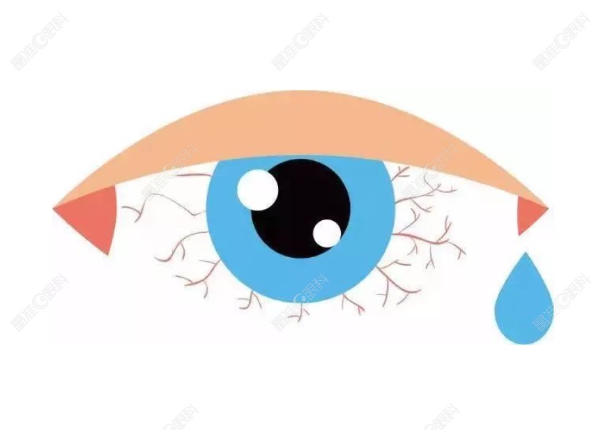 干眼症能做半飞秒手术吗？