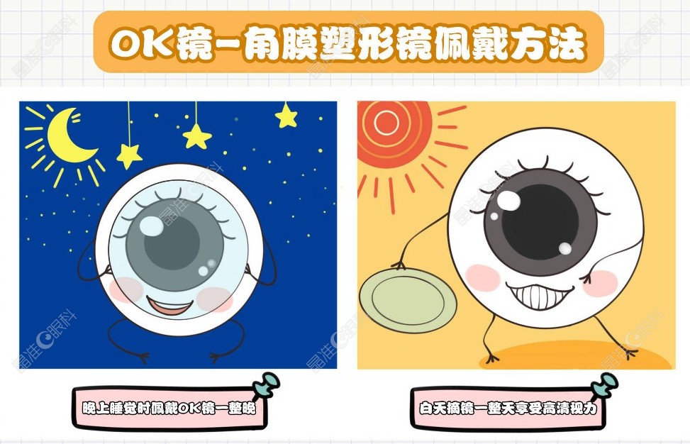 达州睛阅眼科OK镜怎么样