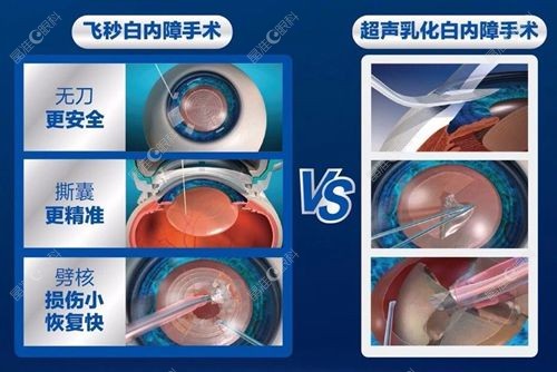 佛山爱尔眼科