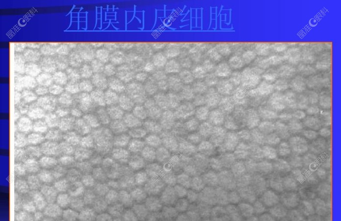 角膜内皮细胞示意图