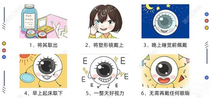 戴角膜塑形镜的手术方式