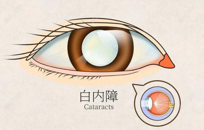 爱博诺德a1-uv和a2-uv区别www.ji-z/hun.com