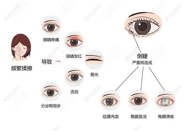 爱尔眼科倒睫手术一般多少钱