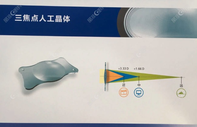 三焦人工晶体到底有哪些不足呢